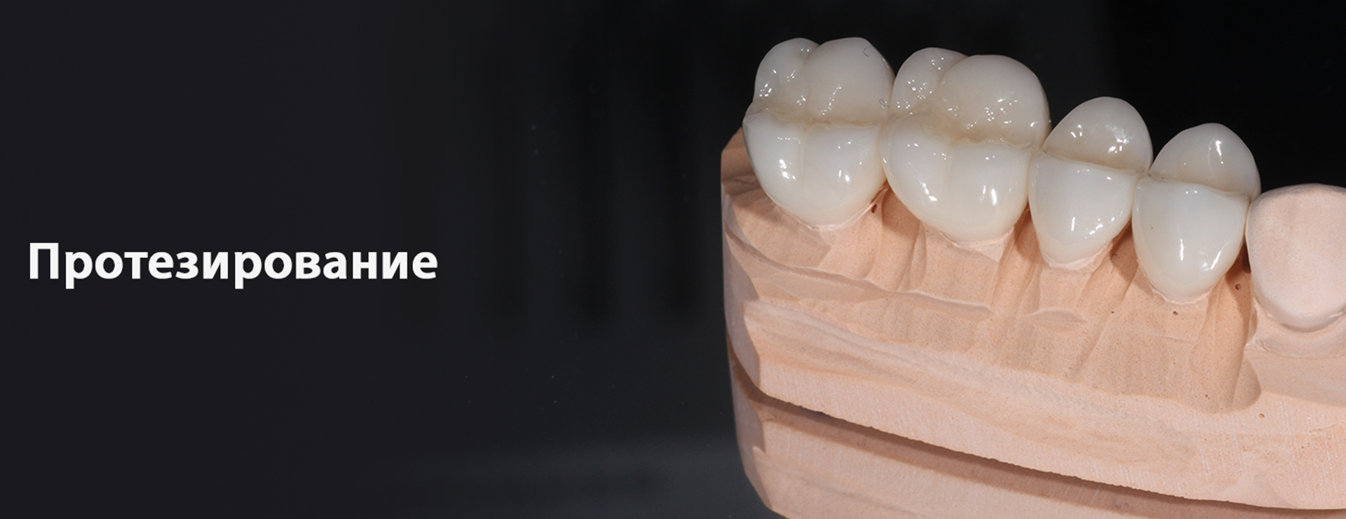 Что такое протезирование зубов